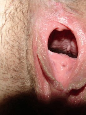 ХХХ фото #3749 - Голые девки, Киски, Из ВК